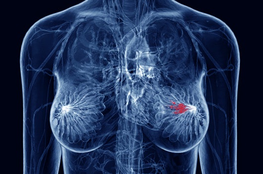 Liberate the Breast Cancer Genes