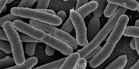 E.Coli produced Spider Silk