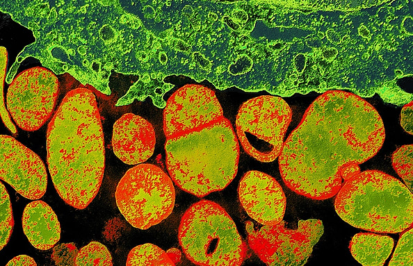 Complete Computer Simulation of a Bacterium Holds Hope for Medicine ...