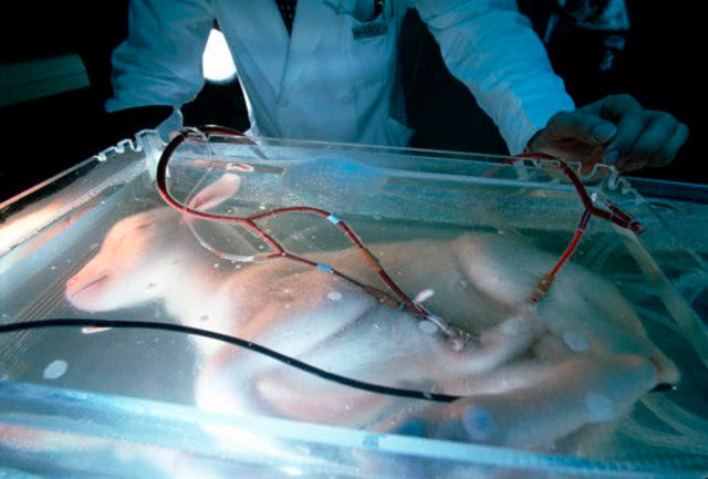 The birth of the artificial womb