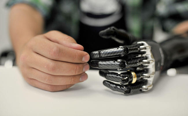 Man Controls Prosthetic Arm with His Mind