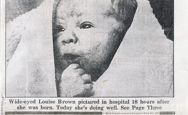 1978 - World’s First ‘Test Tube Baby’ Born