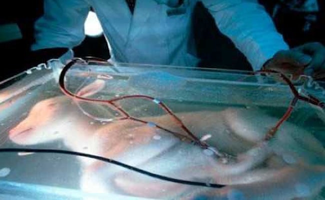 1996 - First Artificial Womb Experimented