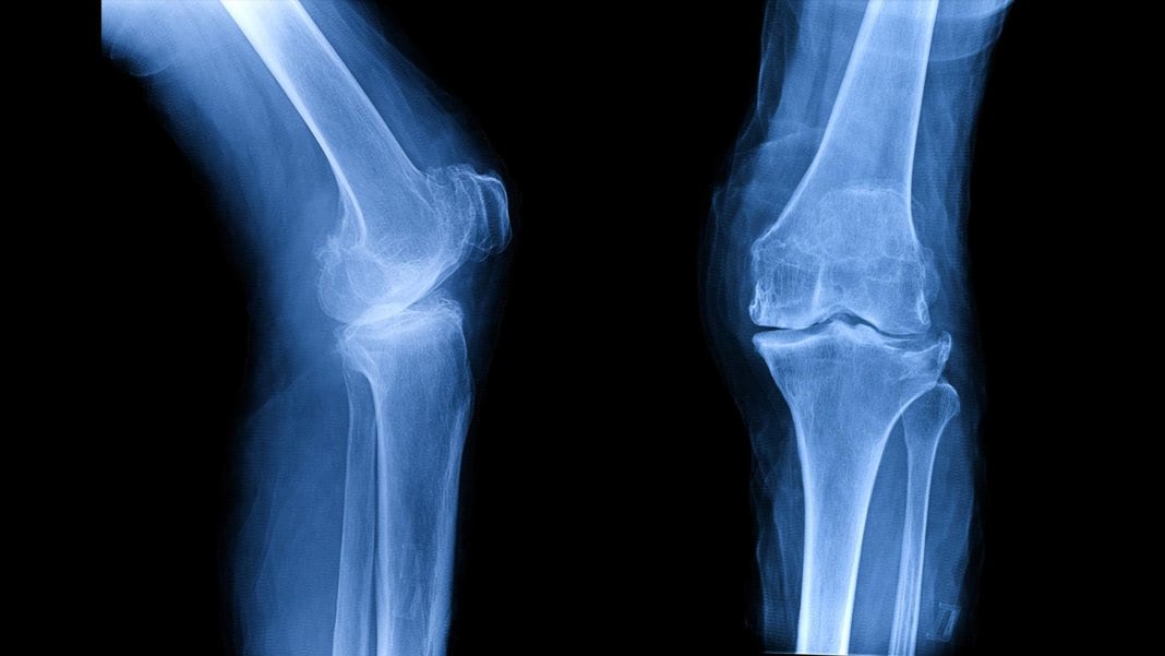 Custom-grown bones, and other wild advances in regenerative medicine