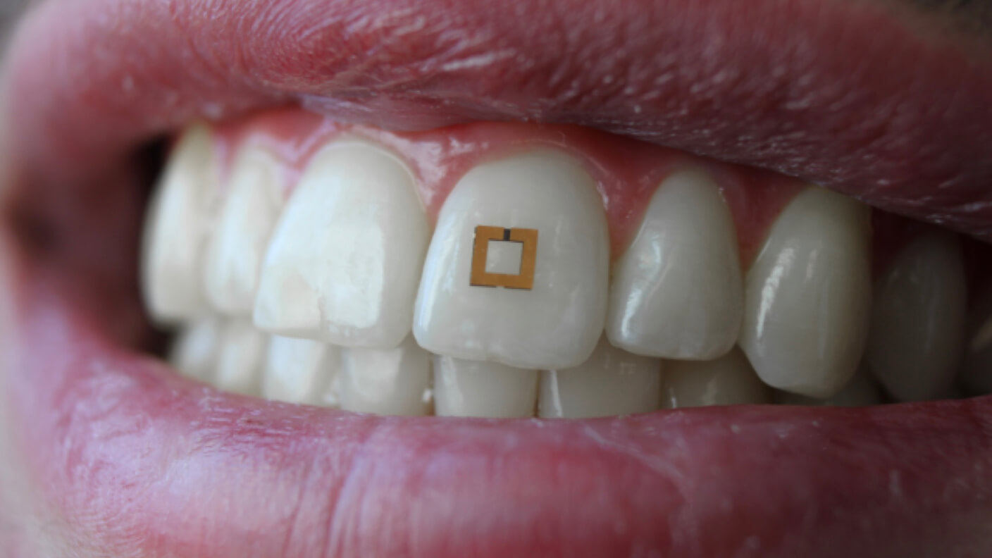 This tiny tooth sensor tracks what you eat, and it could help you be healthier